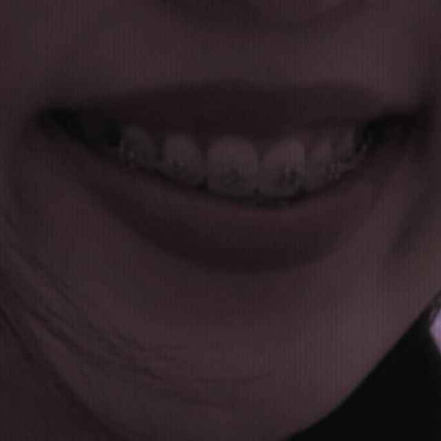 SONRISA DE METAL