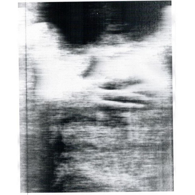 Be Quiet and Drive album image