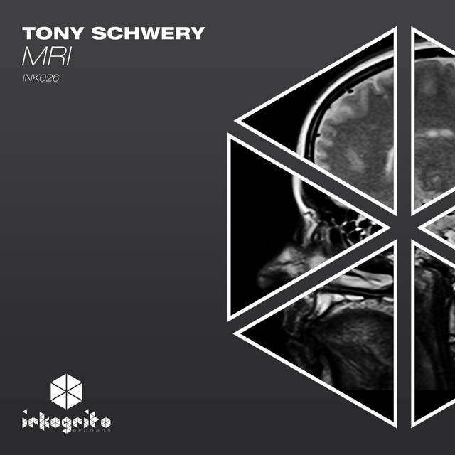 MRI - Radio Edit