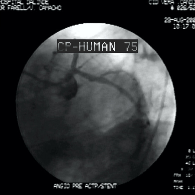 Human 75 cover