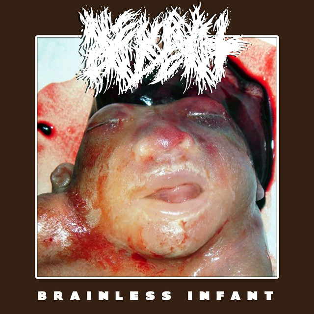 Brainless Infant cover art