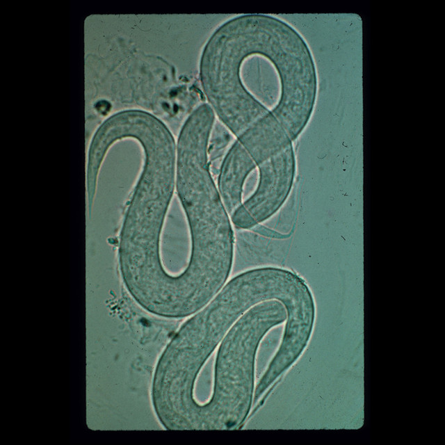 Zeckenentferner cover art