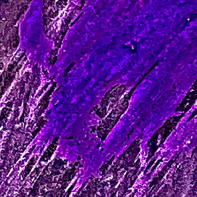 Plastic cover art