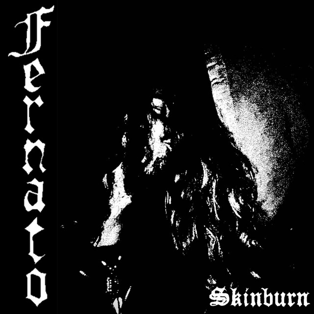 Skinburn cover art