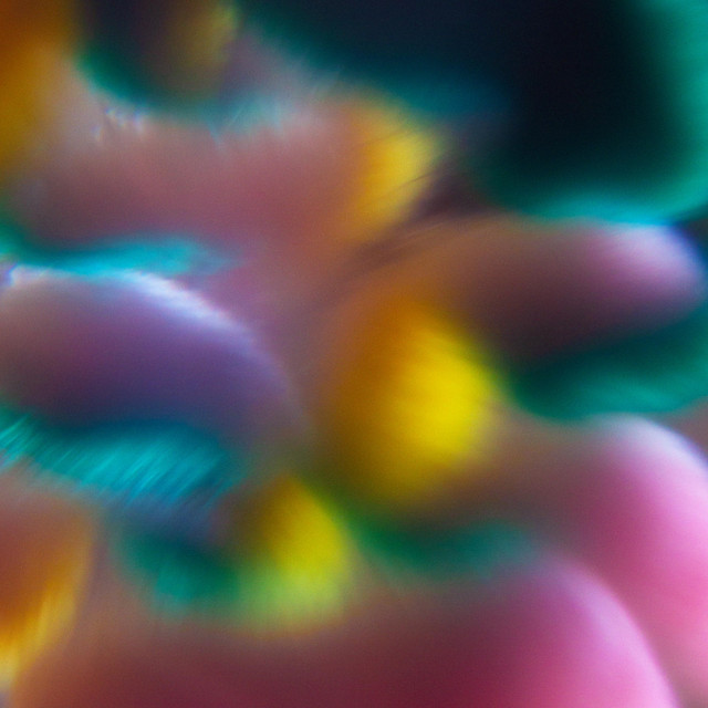 Hypersensitive cover art