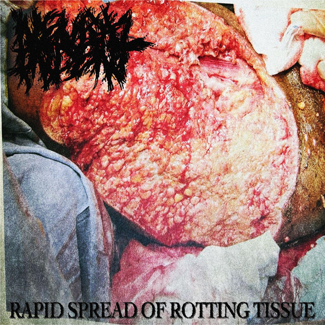 Rapid Spread Of Rotting Tissue cover art