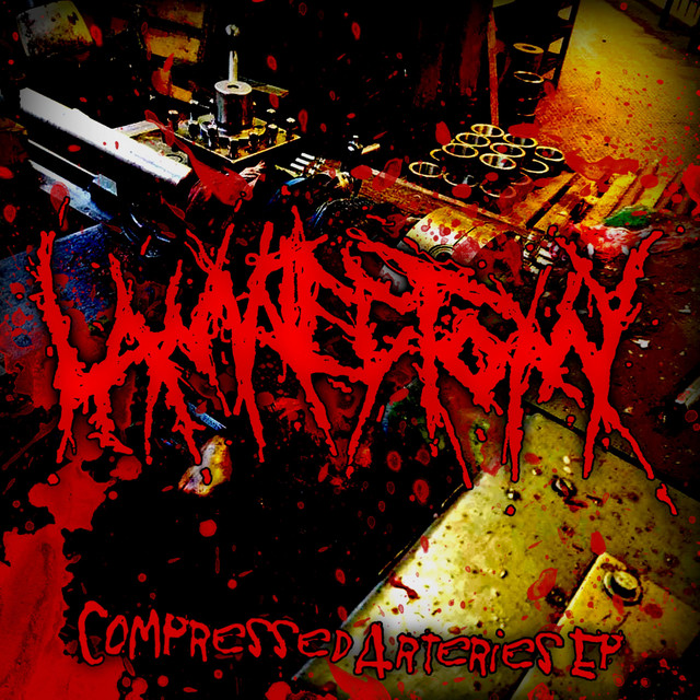 LAMINECTOMY