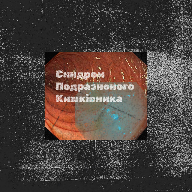 Cover art for anton malynovskyi — Синдром Подразненого Кишківника
