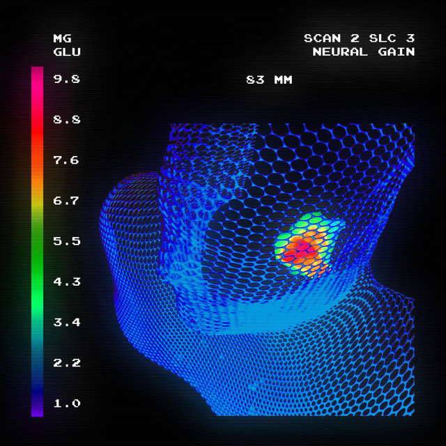 Neural Gain cover art