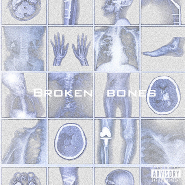 Broken Bones cover art