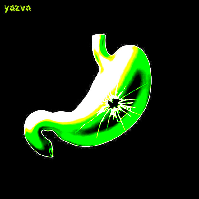 yazva cover art