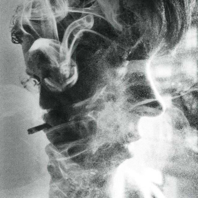 PIRINEOS cover art