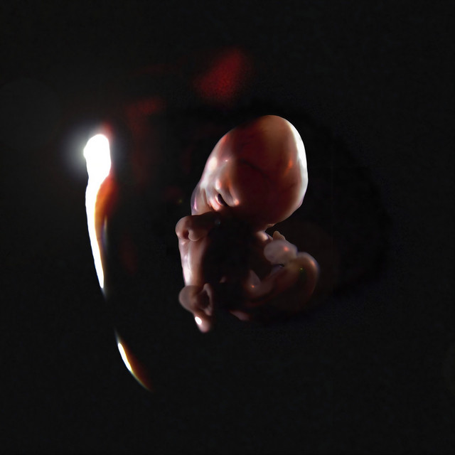 NIBIRU - ENDGAME REMIX cover art