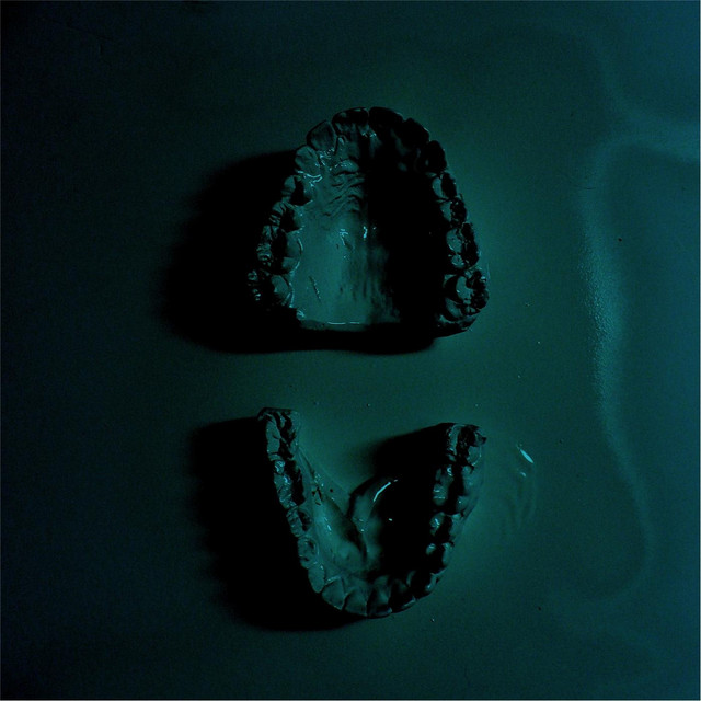 Woglum / Feldspar cover art