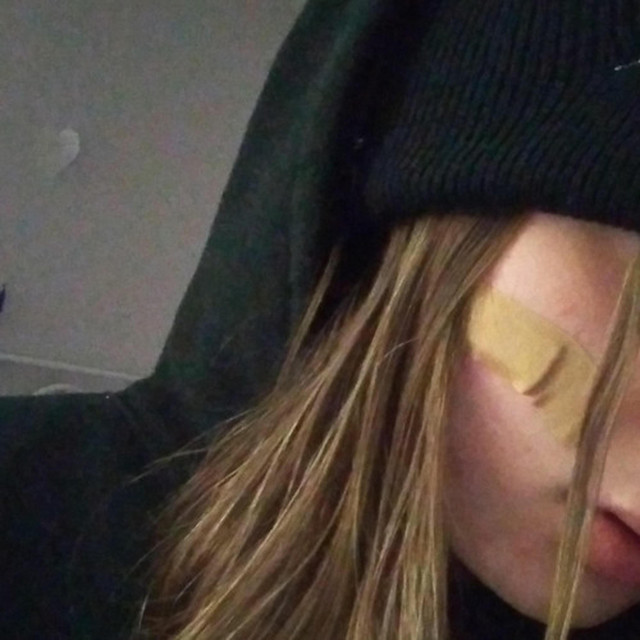 myface i s bleeding cover art