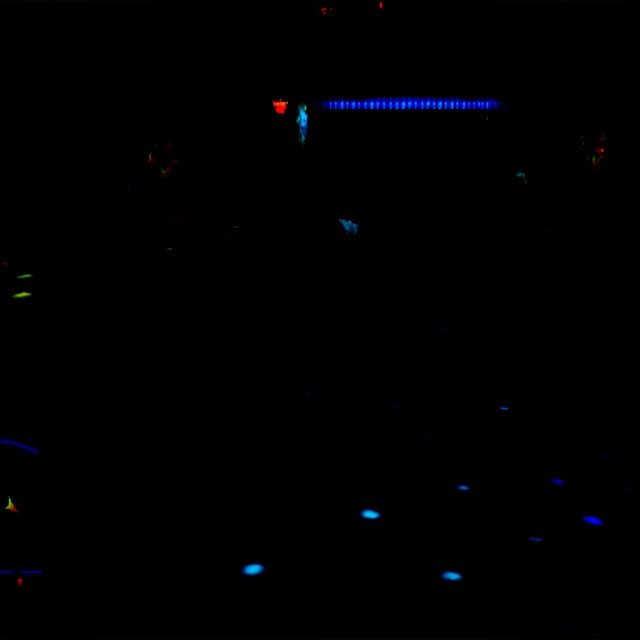 love? (reset) (nightclub version) cover