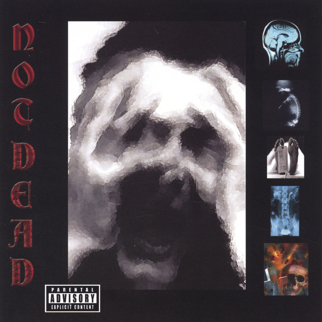 Not Dead cover