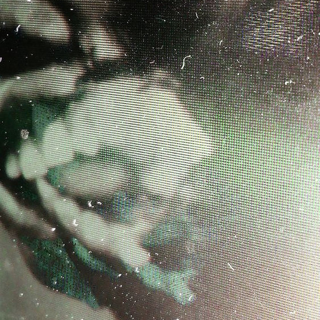 Anger (Intro) cover art
