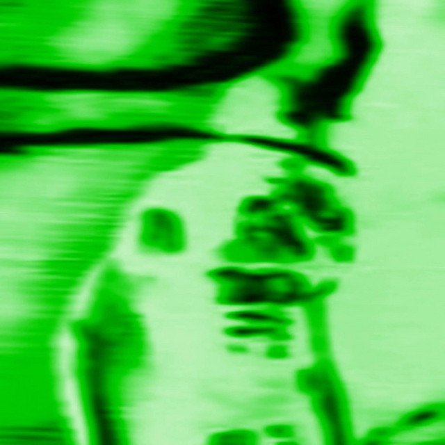 MAX ATTACK cover art