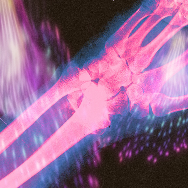 Unrealised cover art