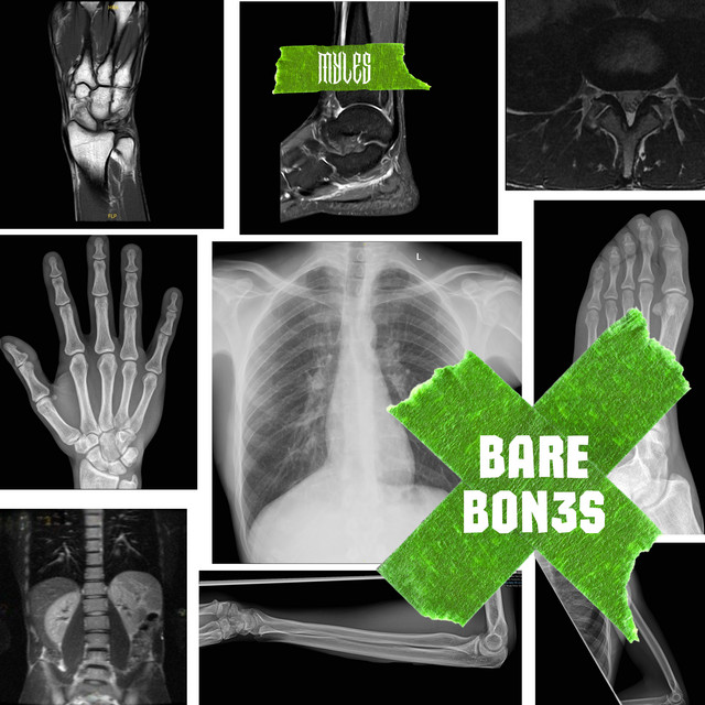 Bare Bones cover art