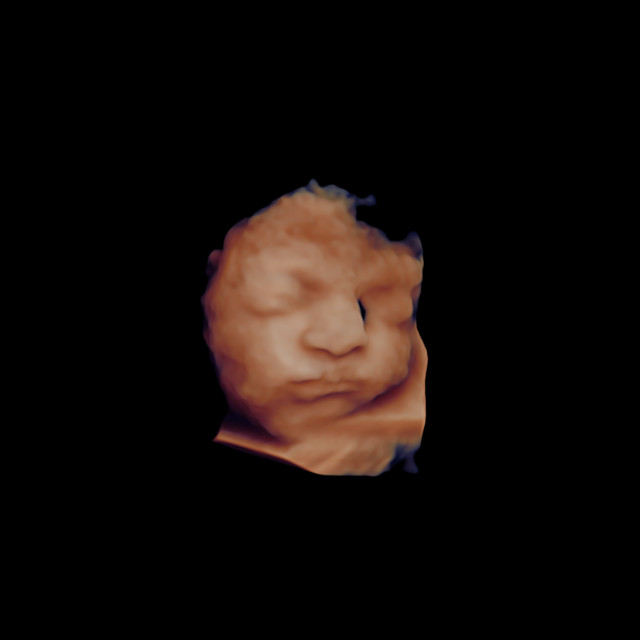 Cessar Fogo (Ao Vivo) cover art