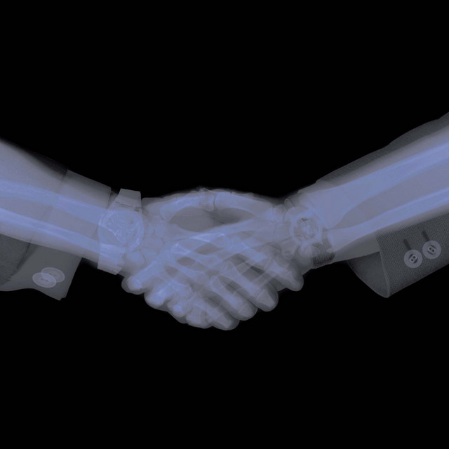 Broken Fingers cover