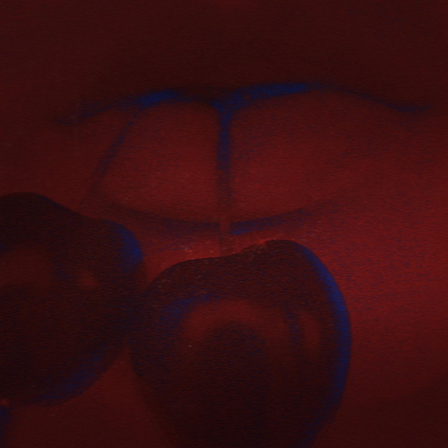 cherry bruises