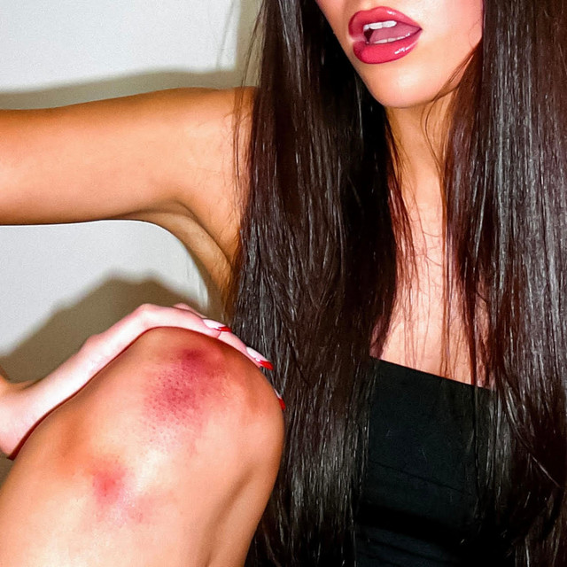 bruises cover art