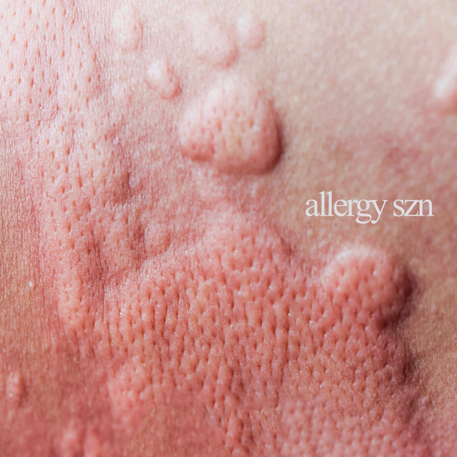 Cover art: Allergy Szn — Roman
