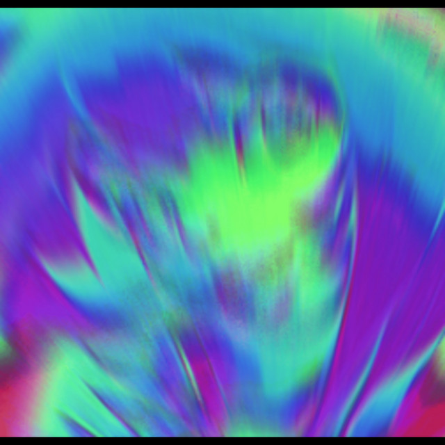 Where Is Lain cover art