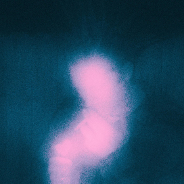 Eastlake (2014) cover art