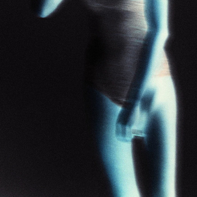 When Beauty Is Broken cover art