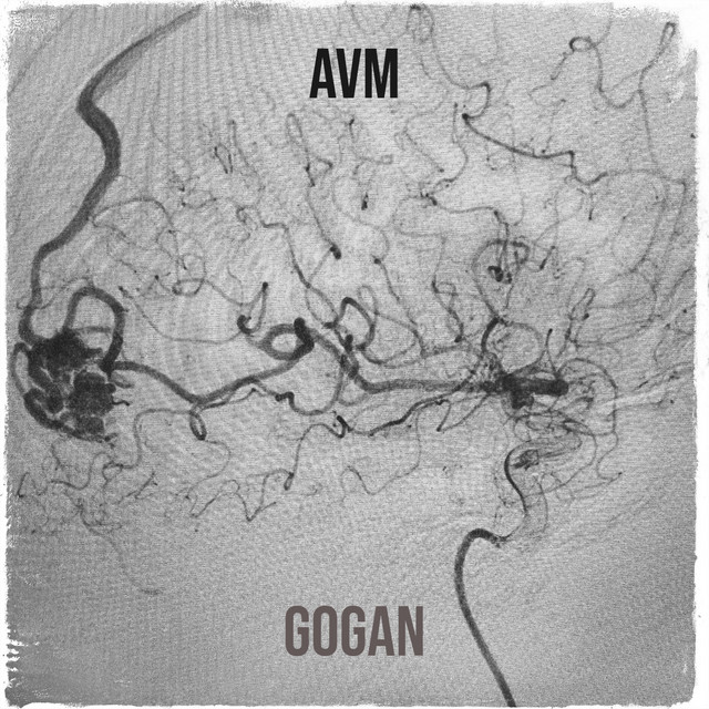Avm cover art