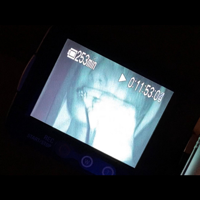 anhedonia (deluxe) cover art