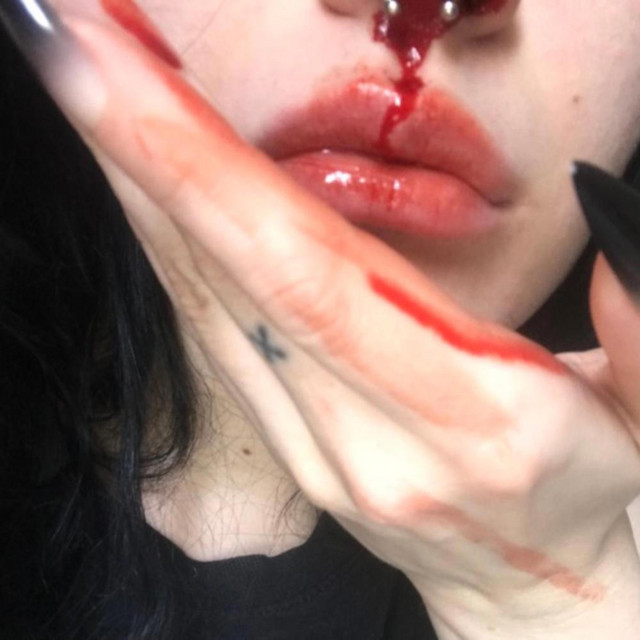 INCISIONS