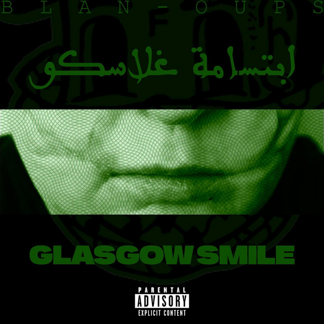 Glasgow smile - إبتسامة غلاسكو (ft OUPS)