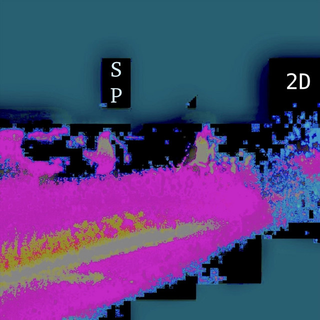 SP2D