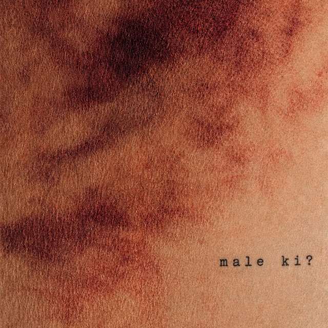 undefined album image