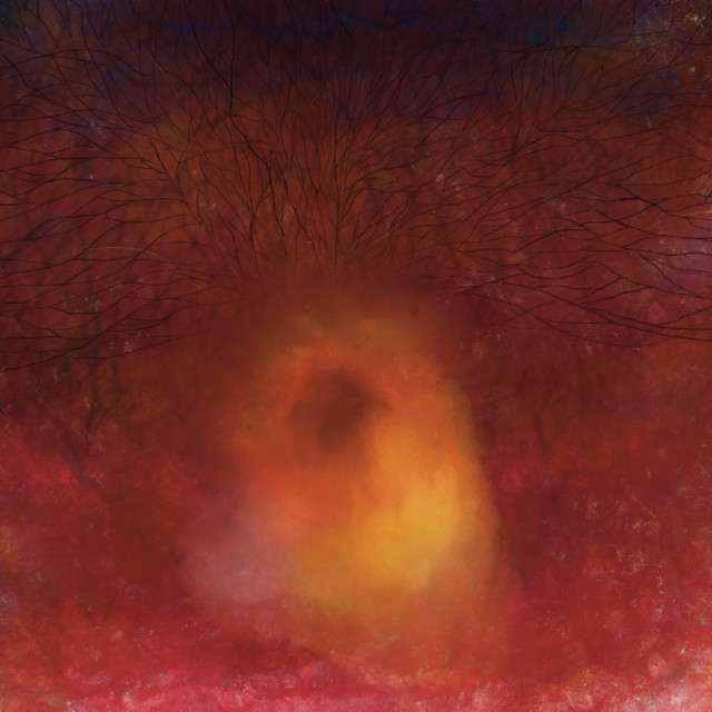 延命措置 cover art