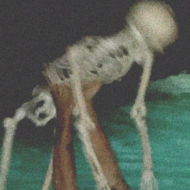 Mood Killer cover art
