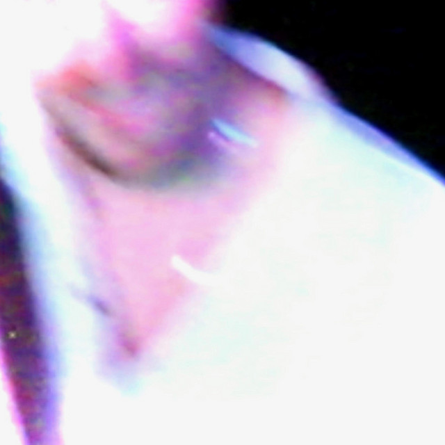 In Extremis