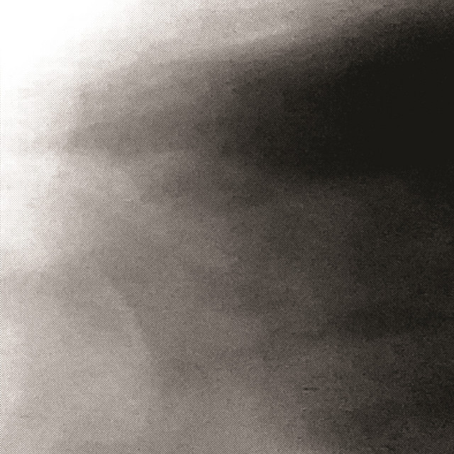 הבטון שלי אפור יותר cover art