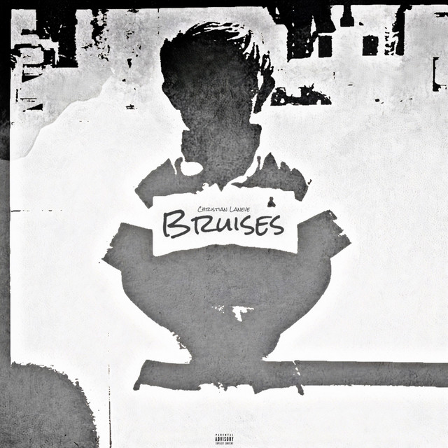 BRUISES