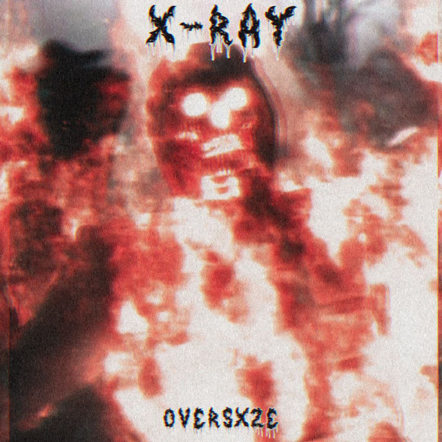 Обкладинка: X-ray — OVERSXZE