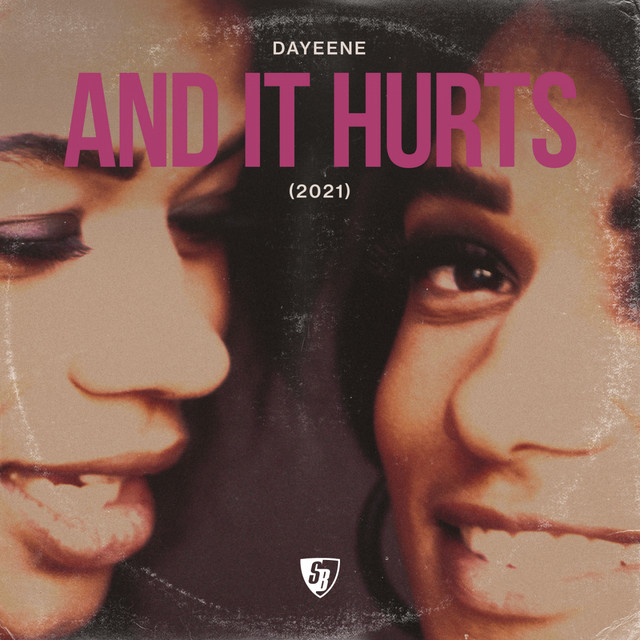 And It Hurts (2021 Remixes) cover