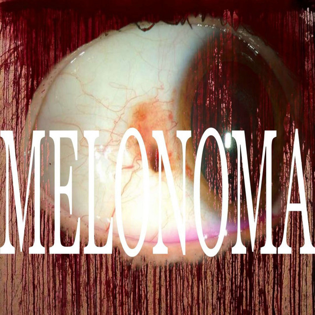 MELONOMA
