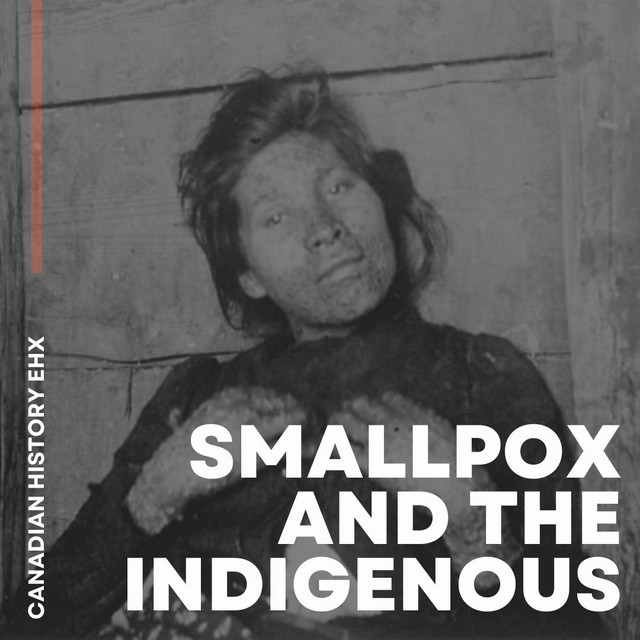 A Deadly Disease: Smallpox and The Indigenous - Canadian History Ehx ...