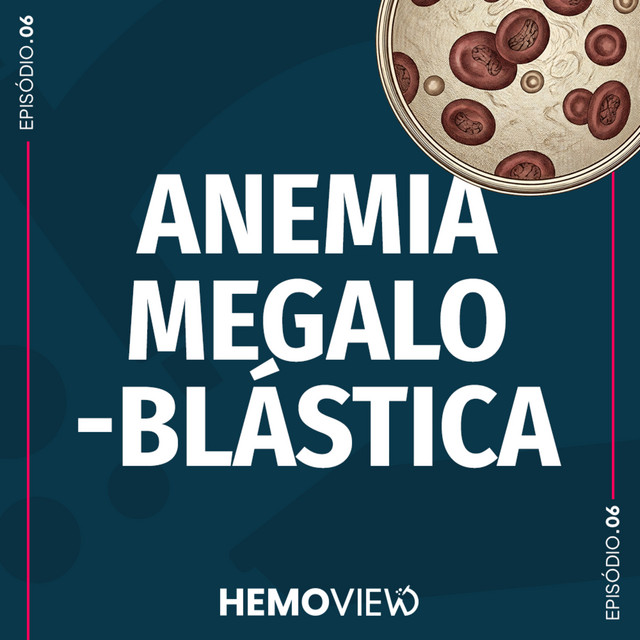 Anemia Megaloblástica: como suspeitar, investigar e tratar | HemoView #6