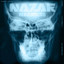 Narkose cover